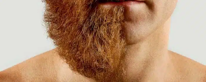 Barba si o no
